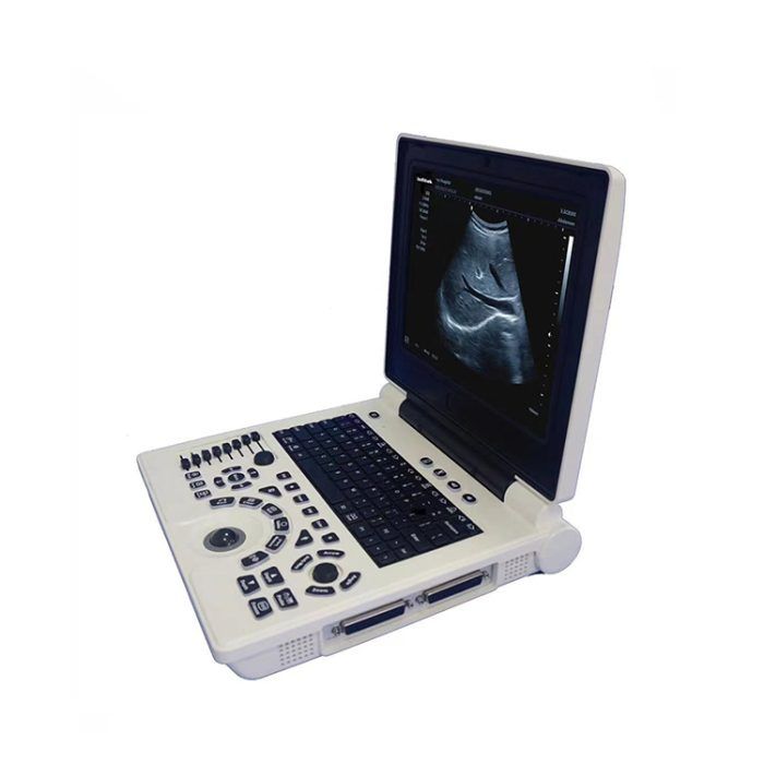 Ultrasound-Machine-Black-&-White-US-HP20